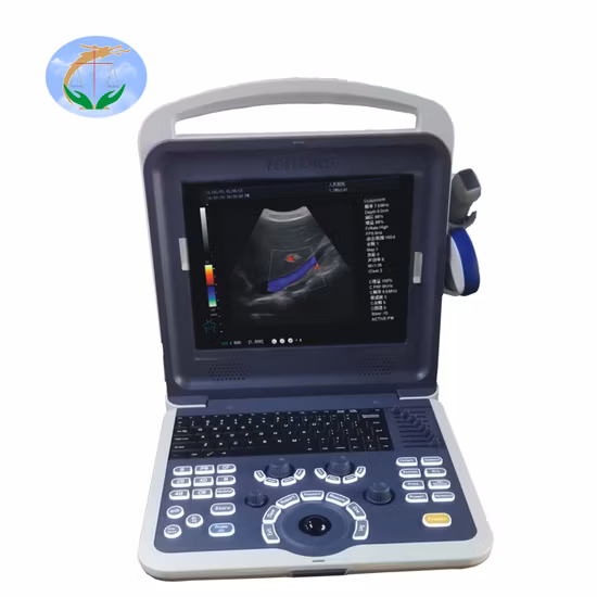 Portable médical 12 pouces LED Full Digital Color Doppler Diagnostic Ultrason Machine
